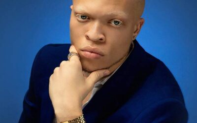 Meet Semme the 22-Year-Old Albino Rapper Taking Over Tik Tok With His Song “Do Dat”