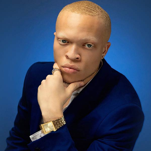 Meet Semme the 22-Year-Old Albino Rapper Taking Over Tik Tok With His Song “Do Dat”